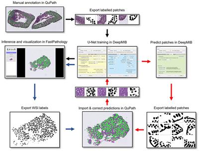 Code-Free Development and Deployment of Deep Segmentation Models for Digital Pathology